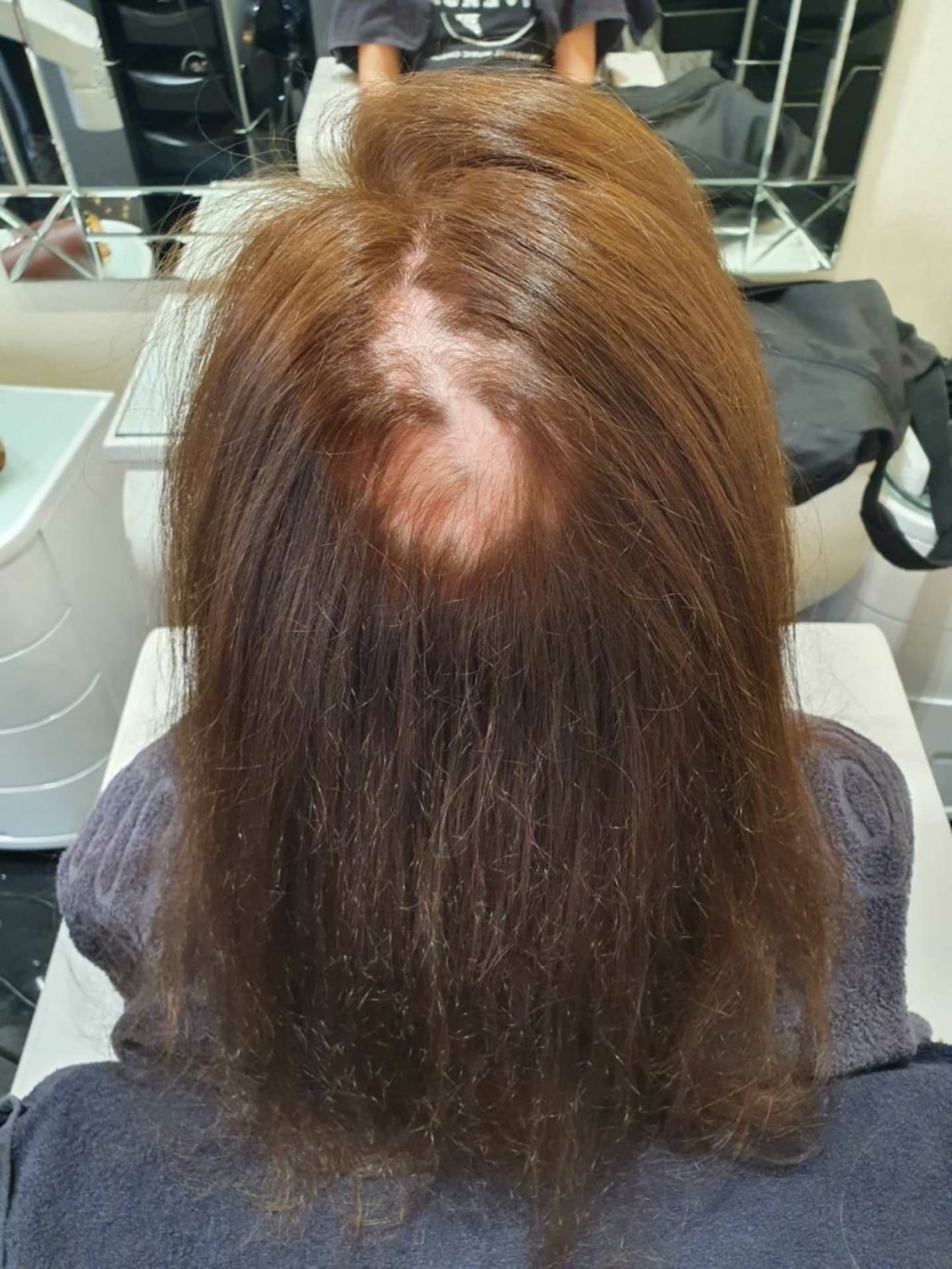 Before picture with woman struggling with hair loss